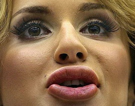 Муж недоволен пухлыми губками Светланы Лободы