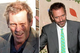 Хью Лори внезапно обзавелся шевелюрой! 