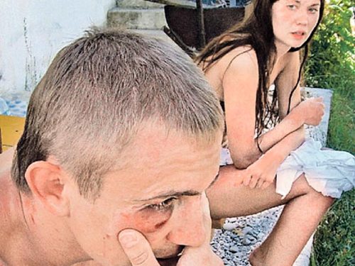 «Вице-мисс Россия» жестоко избили в Турции