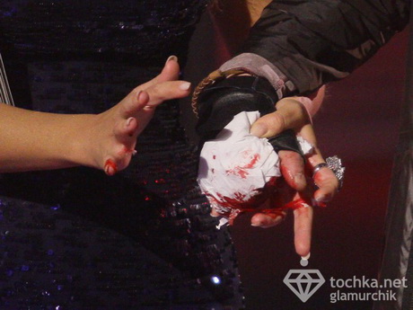 Сцену Х-фактора залито кровью