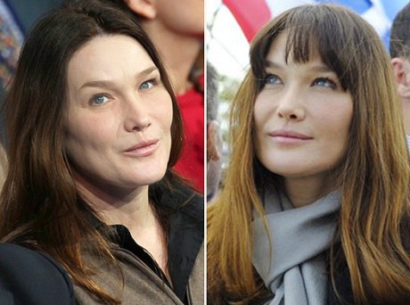 Испорченное пластикой лицо Карлы Бруни начало оживать