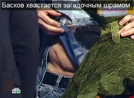 Коля Басков шокировал голым телом!