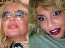 Маша Малиновская осталась без своих роскошных губ