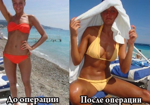 Опубликовано фото Евы Бушминой до пластической операции! Вы будете шокированы!