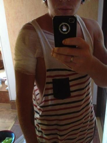 Фото израненного Кривошапко попало в сеть!