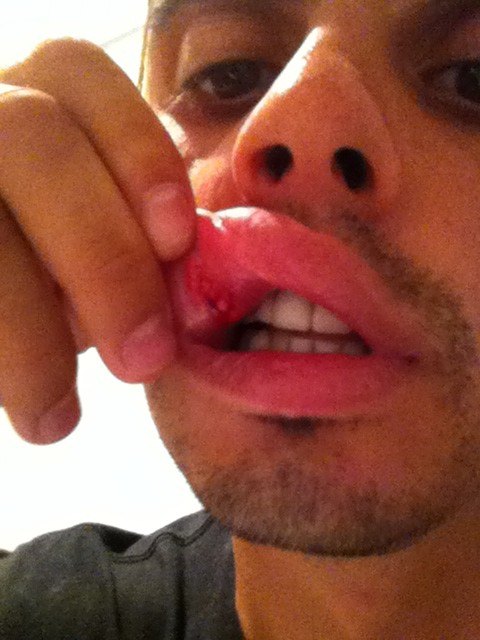 Кирилла Туриченко жестоко избили на улице! Фото побоев уже в сети!