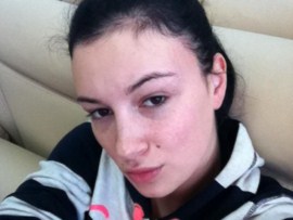 Лицо Анастасии Приходько жутко изуродовано