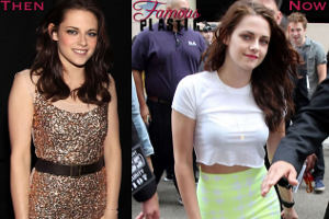 Шок! Юная девочка Кристен Стюарт вставила в грудь импланты!