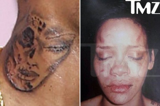 Фото избитого лица Рианны вновь шокировало общественность!