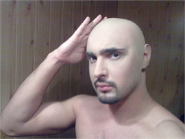 Виталий Козловский внезапно полысел!