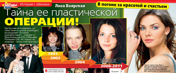Вся правда о пластических операциях Лизы Боярской….
