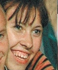 Ксения Собчак сделала очередную пластику: картинки до и после! 