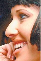 Ксения Собчак сделала очередную пластику: картинки до и после! 