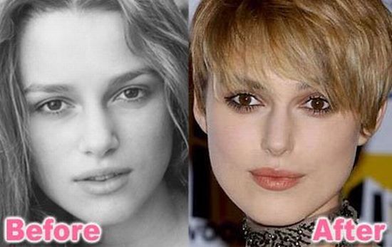 stars_plastic_surgery_29